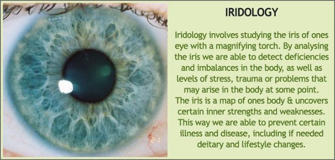 iridoloji iris teşhisi