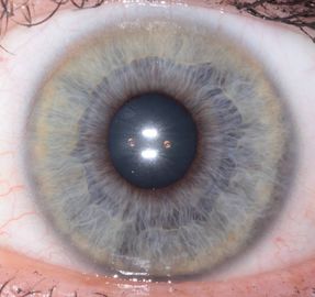 Sağlık Tespit için Taşınabilir CE El Göz İris Tarayıcı Analiz Cihazı