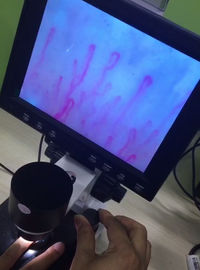 Yeni Nesil Mikrosirkülasyon Mikroskobu, Sağlık İçin Kan Damarı Mikroskobu