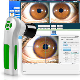 Tıbbi Analiz Cihazı Fizyoterapi Cihazı 12 Megapiksel Göz İridolojisi Kamera Ekipmanları