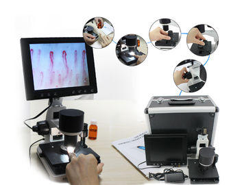 Laptop için Bağlı 600cd / m2 Mikrosirkülasyon Mikroskop Nailfold Kılcal Testi