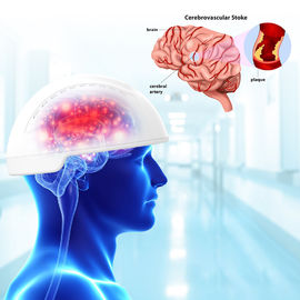 Travmatik Beyin Hasarı Beyin Fotobiyomodülasyon Cihazları 810nm Dalga Boyu