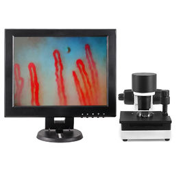 Kan Kılcal Mikrosirkülasyon Mikroskobu 600X Büyütme DC12V 2A Çıkışı