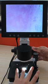 CE ile 380000 piksel Renk Nailfold Mikrosirkülasyon Ekipmanları Kapiler Mikroskop