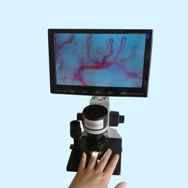 LCD Ekran Renkli Mikro Dolaşım Test Cihazı Klinik Hastane