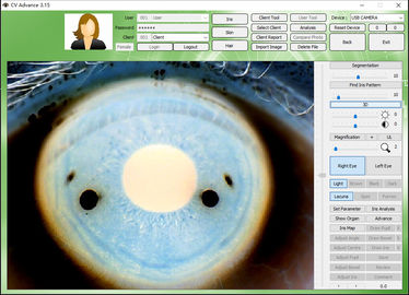 12.0MP Dijital Iriscope Iridology Kamera Göz Test Cihazı CE / DHL Onayı